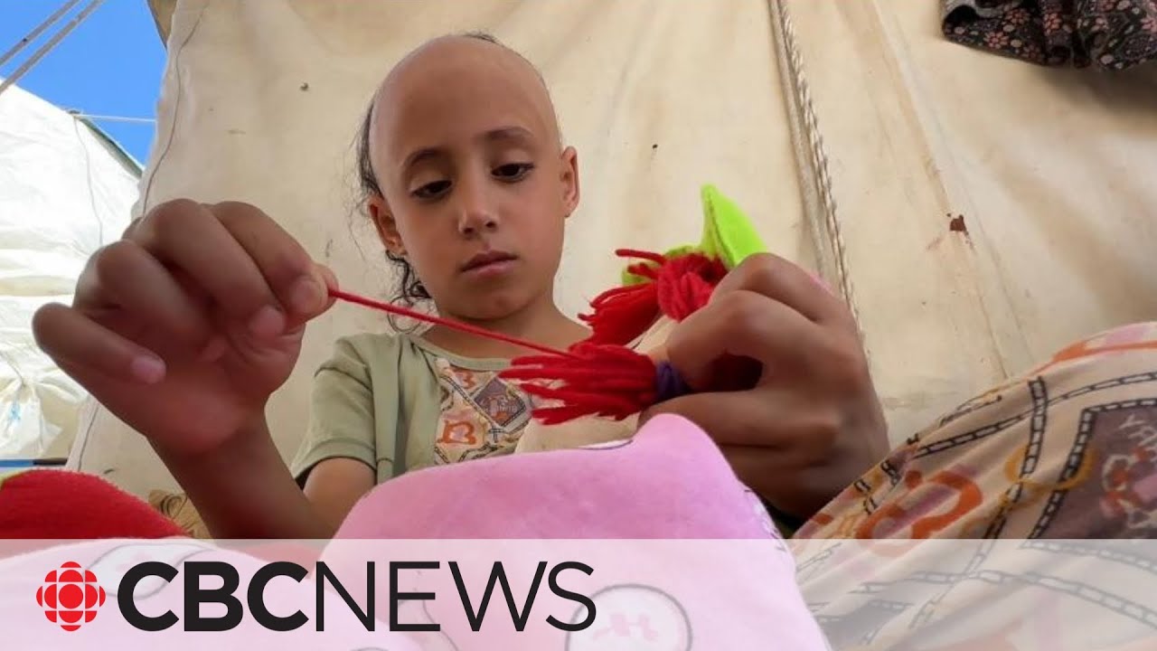 Trauma causes hair loss for 8-year-old girl in Gaza