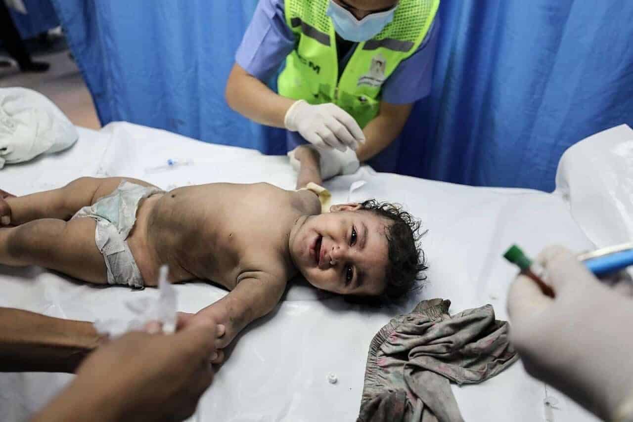 A baby being treated at a hospital in gaza after being wounded in an israeli airstrike.