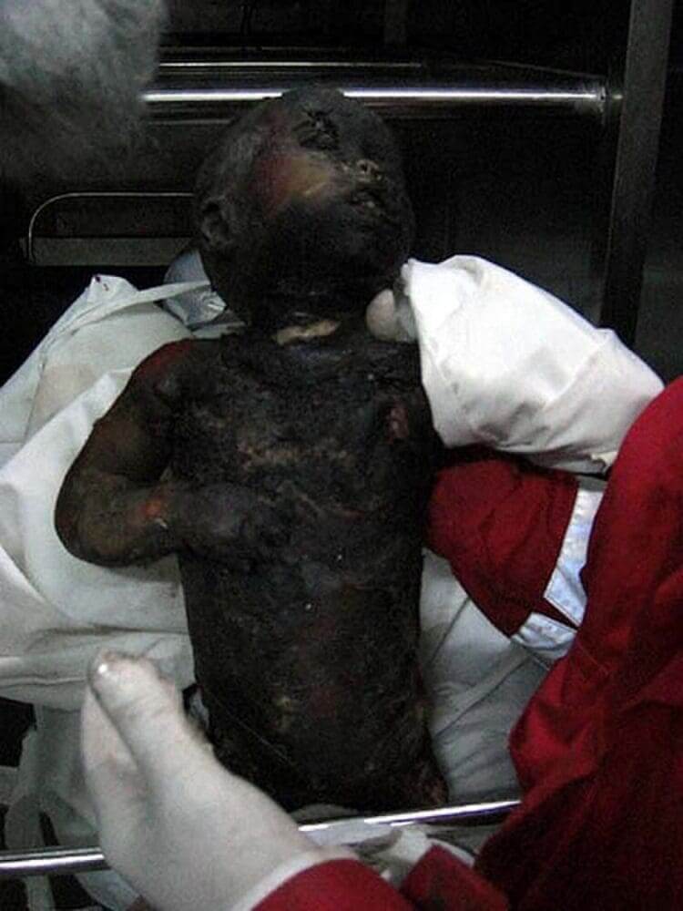 A baby retrieved from attattra, northwestern gaza, where paramedics estimate 100s of calls to retrieve the injured and the dead have gone ignored due to israeli troops occupation of the area. Despite geneva conventions, medical personnel are not able to reach the wounded, many of whom are critically wounded and will die due to the prevention of medical access. This baby, killed in an explosion, was then run over by an israeli tank, according to aid workers who eventually retrieved the body