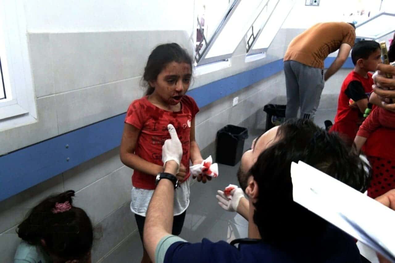 A refugee child injured by bombing in gaza.